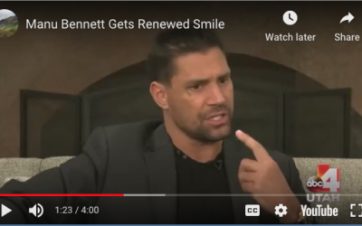 Dr. Meden and Actor Manu Bennett’s New Smile