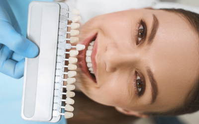 Porcelain Veneers vs. Composite Bonding: Which is right for me?