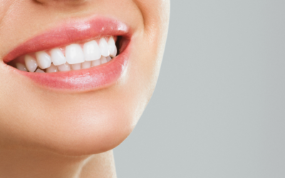 Best Ways to Whiten Your Teeth: A Comprehensive Guide