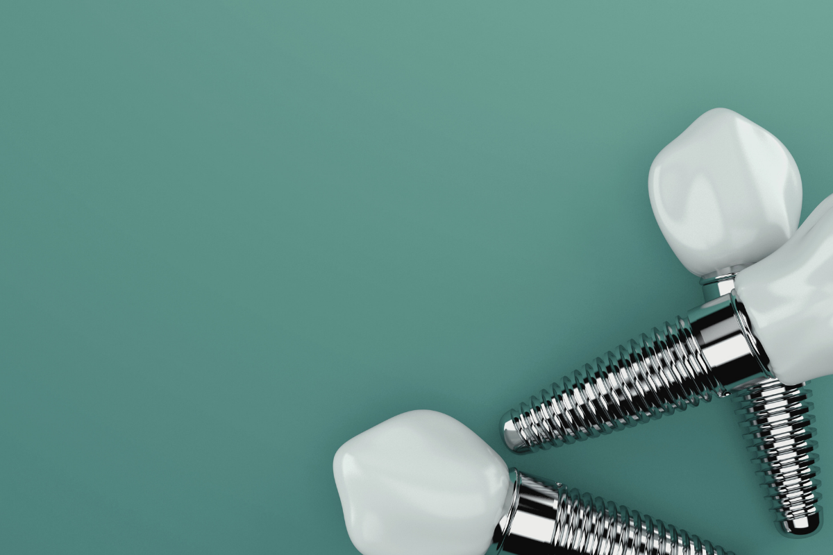 What Factors Impact Dental Implant Success?